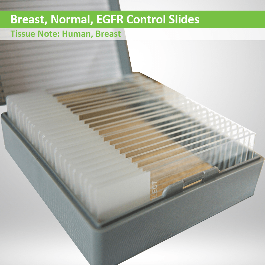 Breast Control Slides Normal EGFR