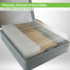 Prostate Normal Control Slide Set