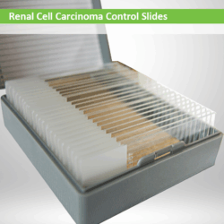 Renal Cell Carcinoma Control Slide Set