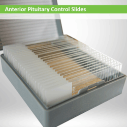 Anterior CS032 Control Slides