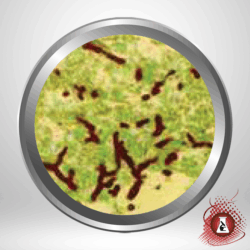 Gomories Methenamine IMEB Microwave Silver Stain Kit