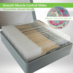 Smooth Muscle Control Slide Set