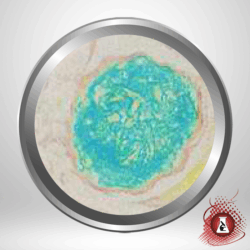 Colloidal Iron Stain Kit