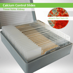 Calcium Control Slides