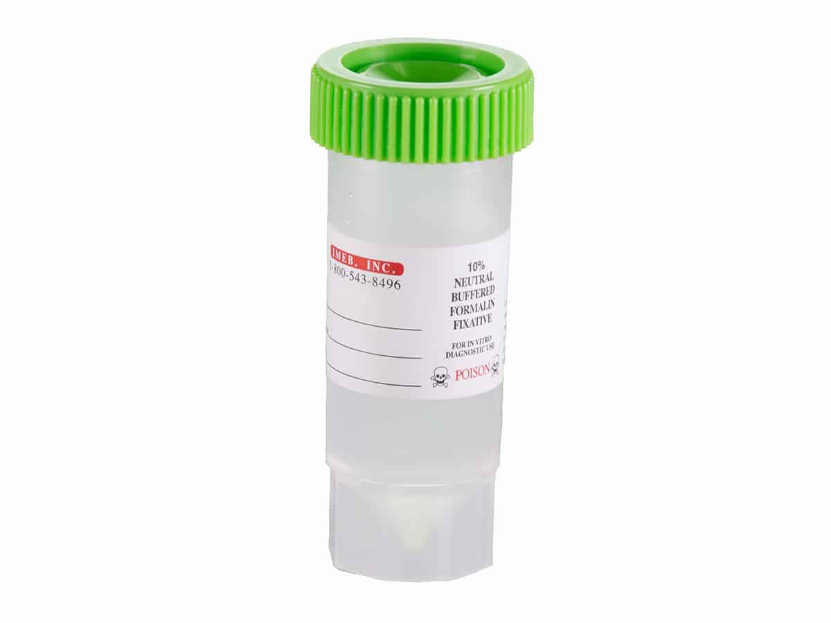 Tek-Select® Prefilled 10% Formalin Vials 30 ml