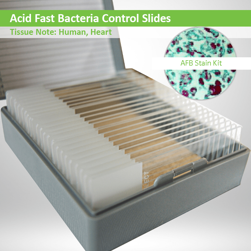 Acid Fast Bath Control Slide with AFB Stain Kit