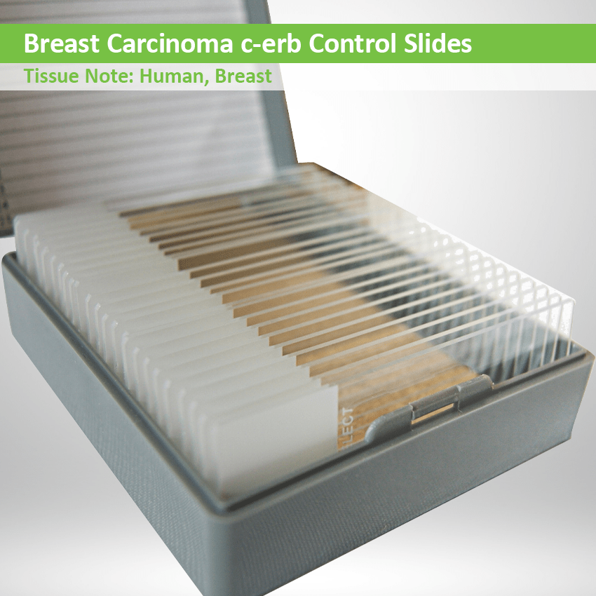 Control Slides Breast Carcinoma c-erb