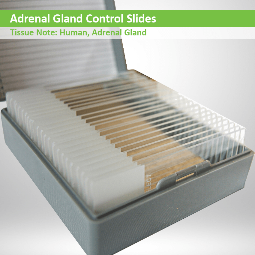 Adrenal Gland Control Slides