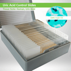Uric Acid Control Slide Set
