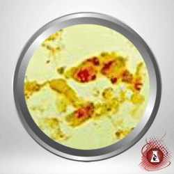 Brown and Brenn Gram Modified Stain Kit K7028A