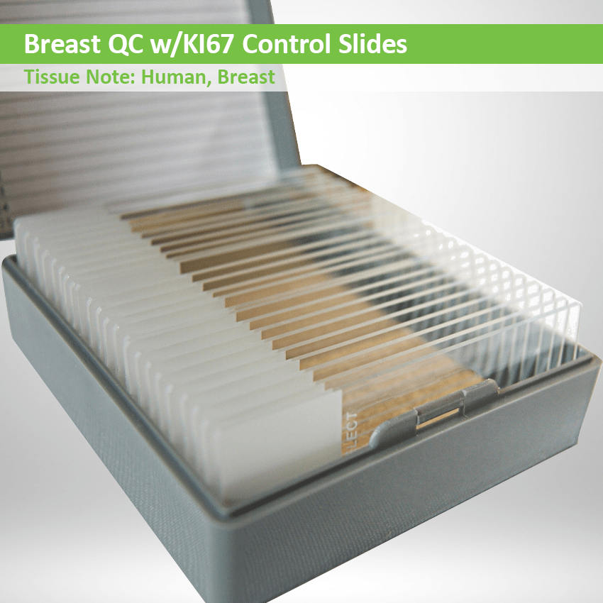 Breast QC with KI67 Control Slide