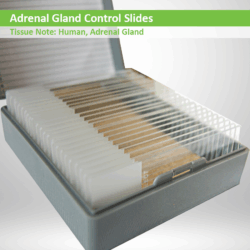 Adrenal Gland Control Slides