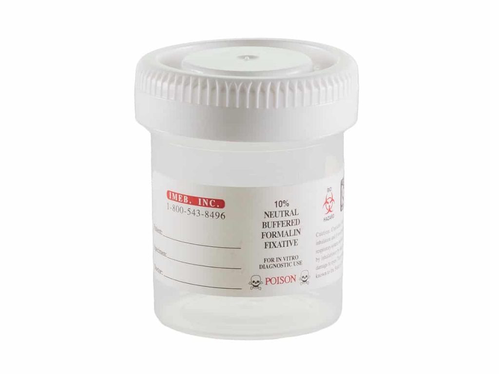 Tek-Select® Prefilled 10% Formalin - 90ml/45mL Prefilled Containers