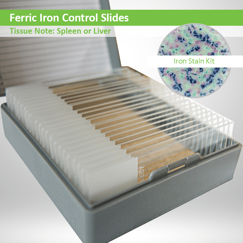 Control Slides Ferric Iron CS045