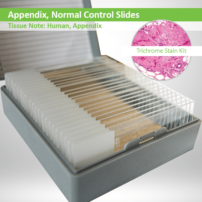 Appendix Control Slides